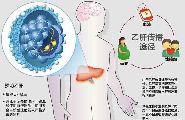 乙肝的預(yù)防措施是什么？
