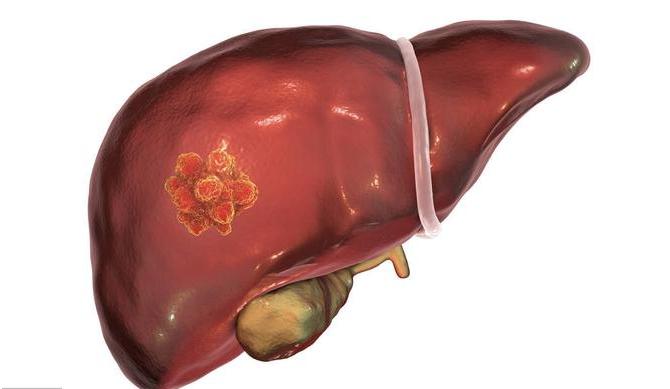 乙肝如何預(yù)防與科學(xué)治療